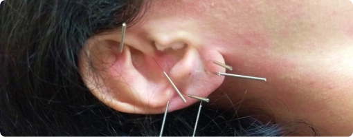 Dr. Roque Queiroz - Ortodontia Especializada em Pinheiro | Imagem de Tratamento Temporomandibular